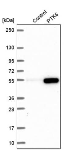 Brk Antibody, Novus Biologicals 25 &mu;L; Unlabeled:Antibodies, Polyclonal